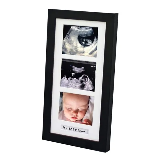 Trlry Keepsake Photo Frame